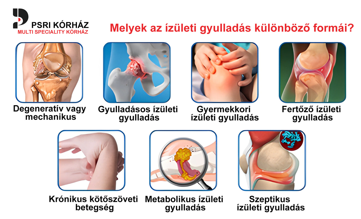 🌿🌿🎁 BEARNICA™ Prémium méhméreg ízületi és csontkezelő krém🔥 (Utolsó napi akció, 70% kedvezmény)
