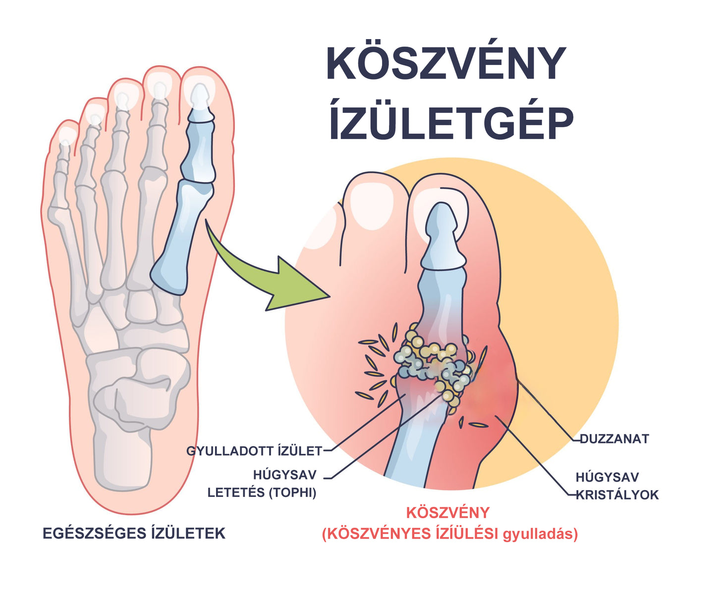 🌿🌿🎁 BEARNICA™ Prémium méhméreg ízületi és csontkezelő krém🔥 (Utolsó napi akció, 70% kedvezmény)