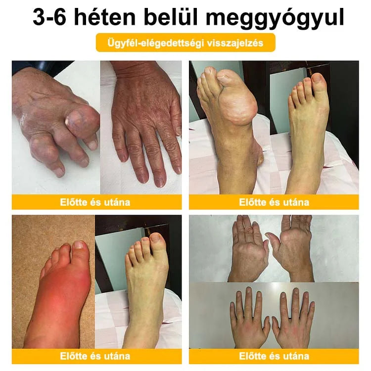 🌿🌿🎁 BEARNICA™ Prémium méhméreg ízületi és csontkezelő krém🔥 (Utolsó napi akció, 70% kedvezmény)