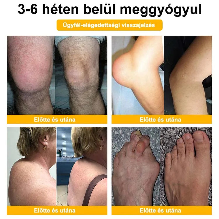 🌿🌿🎁 BEARNICA™ Prémium méhméreg ízületi és csontkezelő krém🔥 (Utolsó napi akció, 70% kedvezmény)