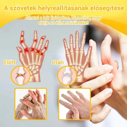 🌿🌿🎁 BEARNICA™ Prémium méhméreg ízületi és csontkezelő krém🔥 (Utolsó napi akció, 70% kedvezmény)