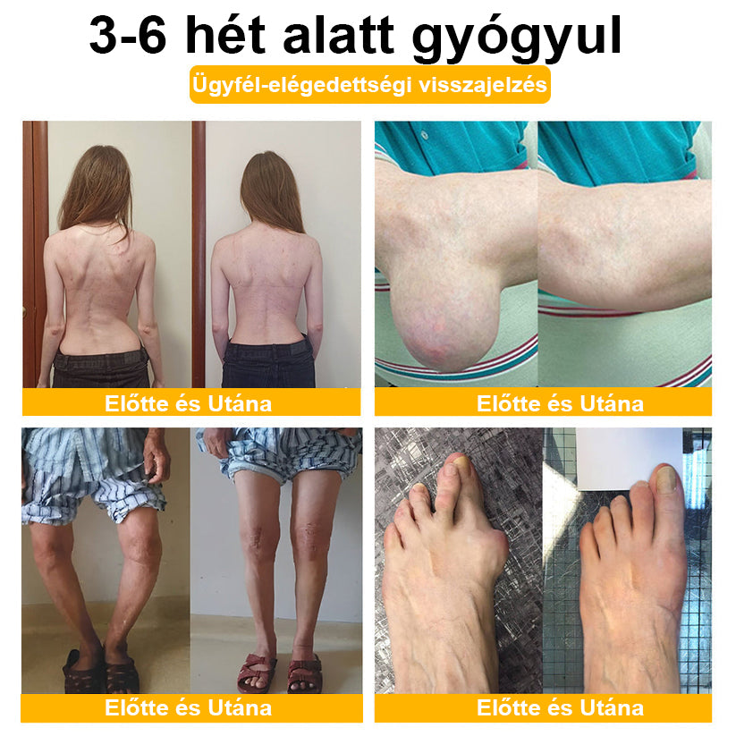 🌿🌿🎁 BEARNICA™ Prémium méhméreg ízületi és csontkezelő krém🔥 (Utolsó napi akció, 70% kedvezmény)